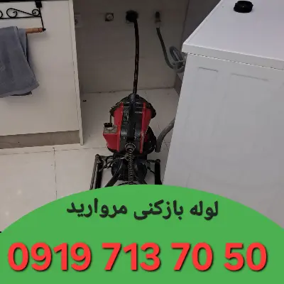 لوله بازکن مروارید تهران 